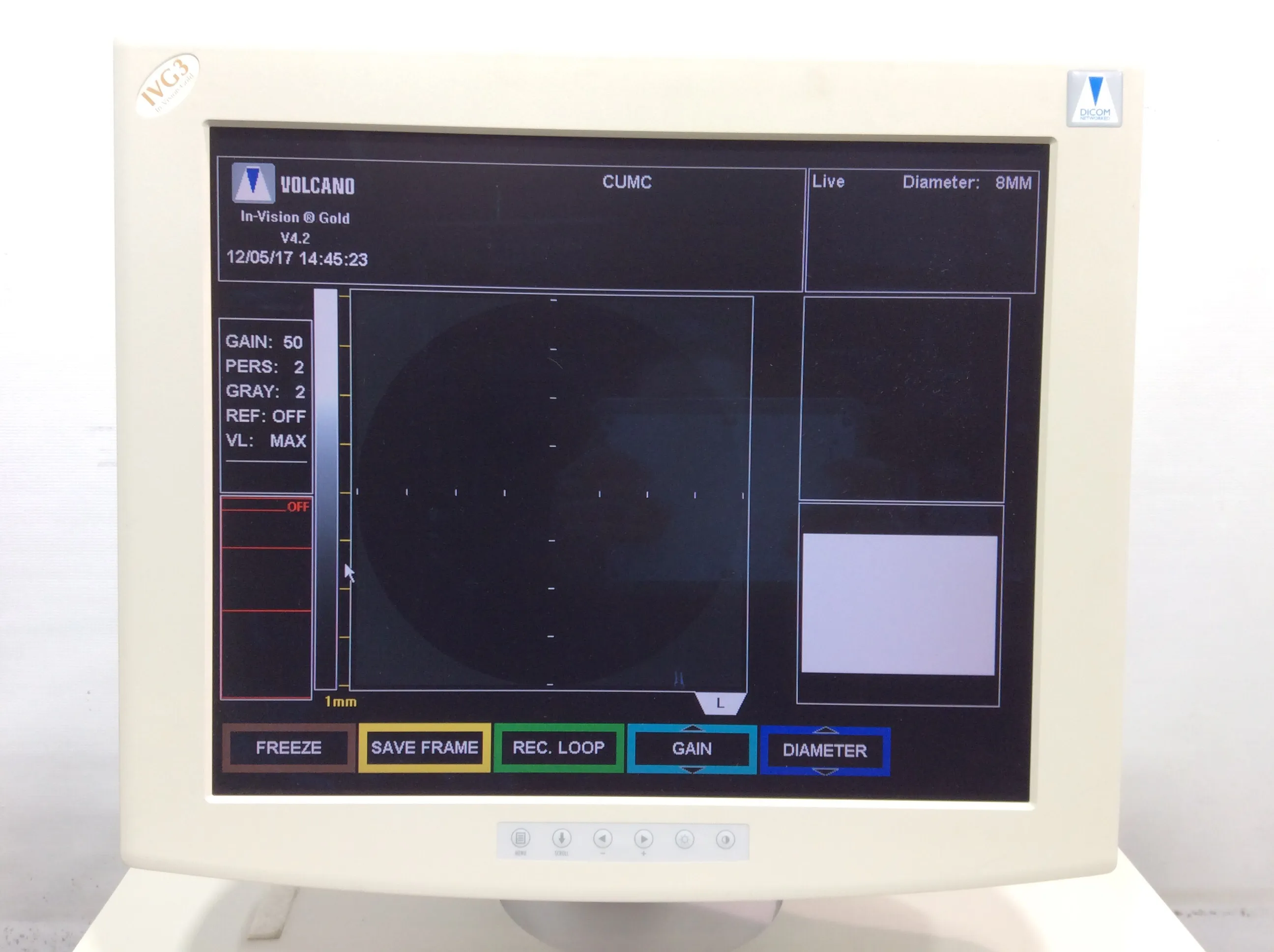 Volcano Therapeutics In-Vision Gold IVG3 Pediatric Intravascular Ultrasound System